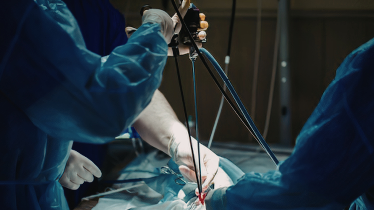 How Does Dr. Zain Mirza Use Endoscopic Techniques for Minimally Invasive Spine Surgery